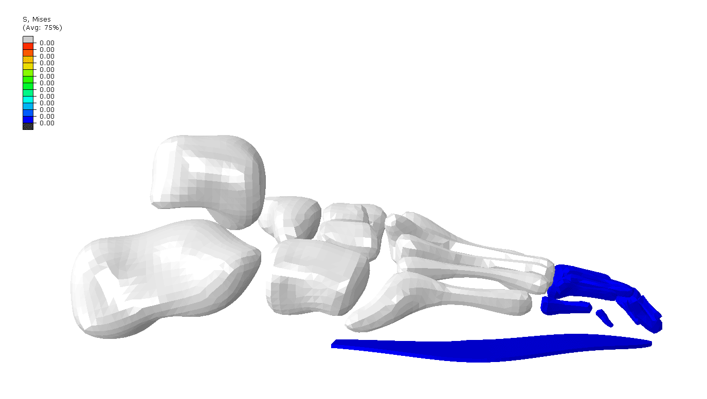 Heel tension